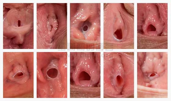 處女膜01.jpg 處女膜01.jpg